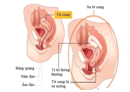 Sa Tử Cung